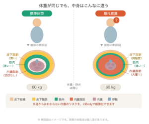 体重・BMIが同じ2人の腹部断面比較図。標準体型は筋肉層が厚く内臓脂肪がほぼない。隠れ肥満は外見は同じでも筋肉層が薄く、内臓脂肪が大量に蓄積している。