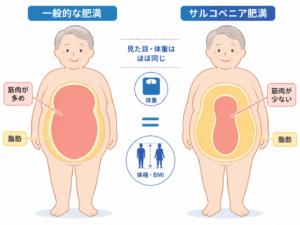 一般的な肥満とサルコペニア肥満を比較したイラスト。見た目や体重、BMIがほぼ同じでも、サルコペニア肥満では脂肪が多く、筋肉量が少なくなっていることを示している。